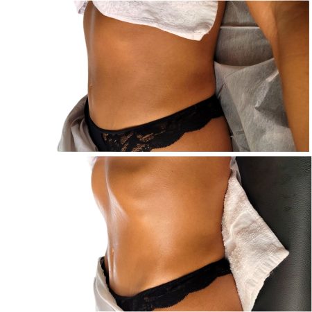 Brazilian Lymphatic Full Body Massage Certificate Training - Monday, October 21,2024