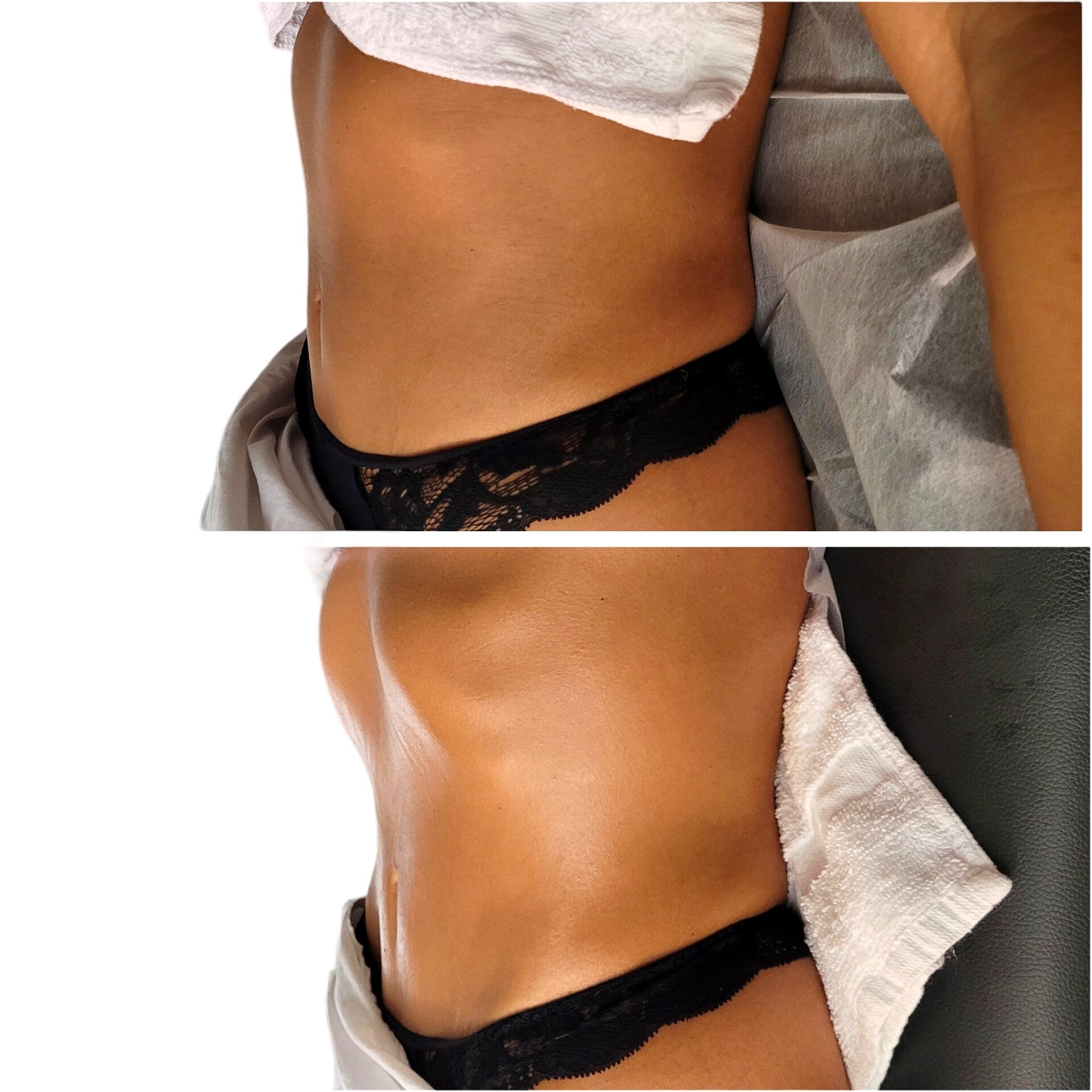 Brazilian Lymphatic Full Body Massage Certificate Training - Monday, October 21,2024